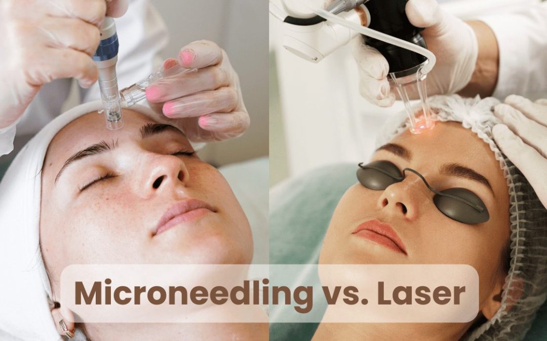 Microneedling and Laser Treatments