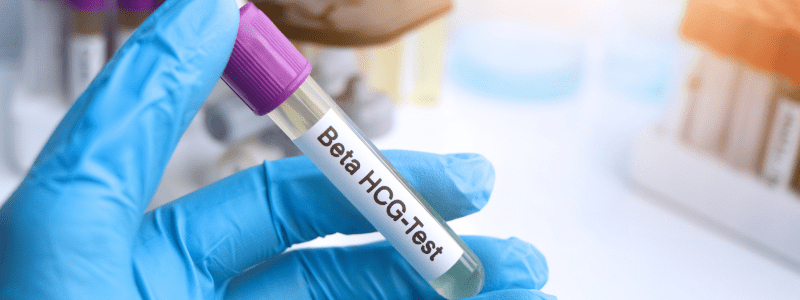 hcg test