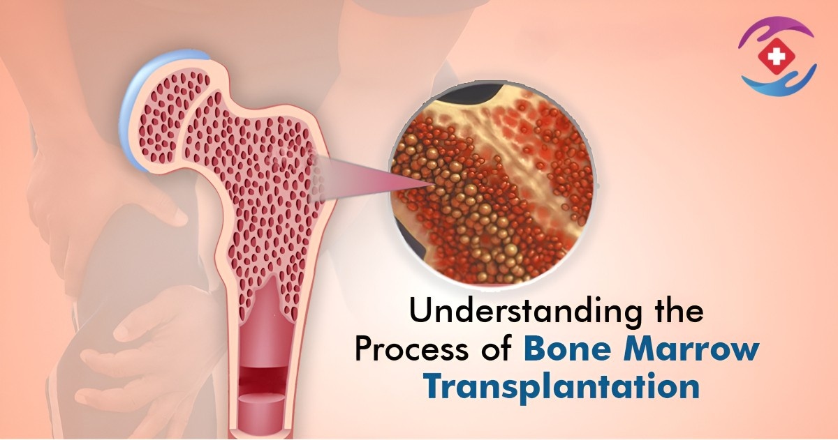 Bone Marrow Transplant