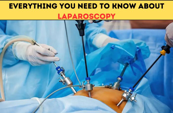 Everything-You-Need-To-Know-About-Laparoscopy