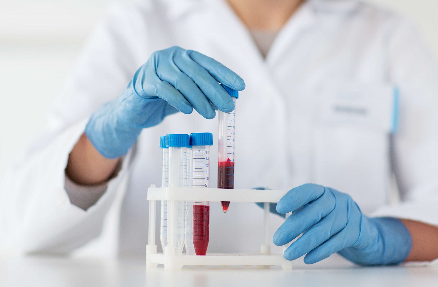 Live Blood Analysis Melbourne