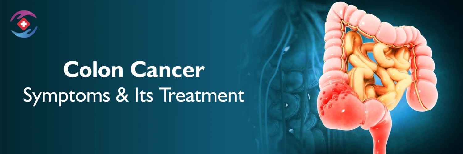 Colon Cancer Treatment